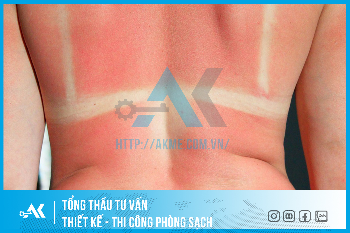 mỹ phẩm kem chống nắng